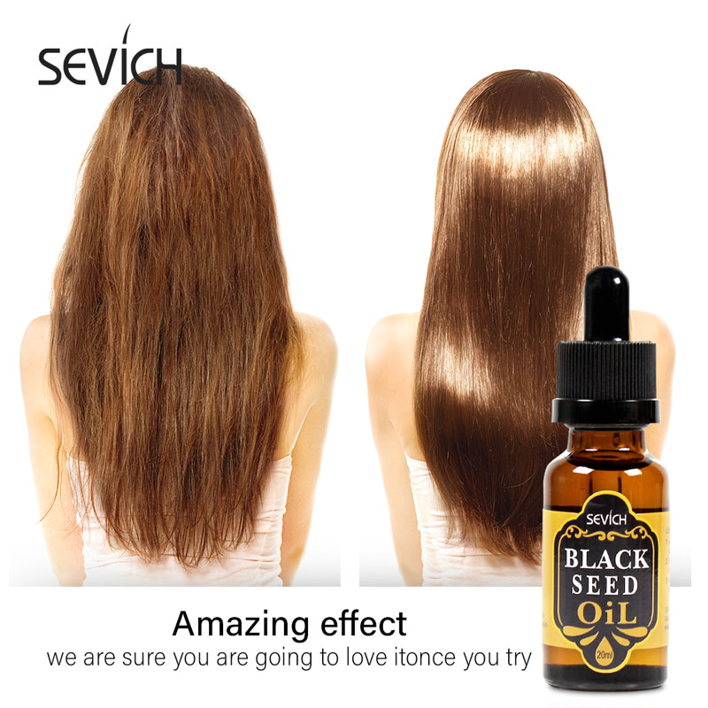 Black Seed Hair Treatment Oil (20ml) - Sevich Hair Care